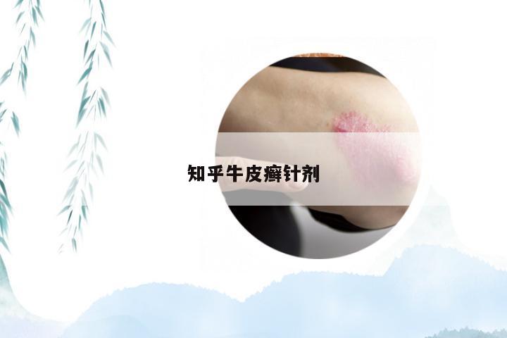 知乎牛皮癣针剂