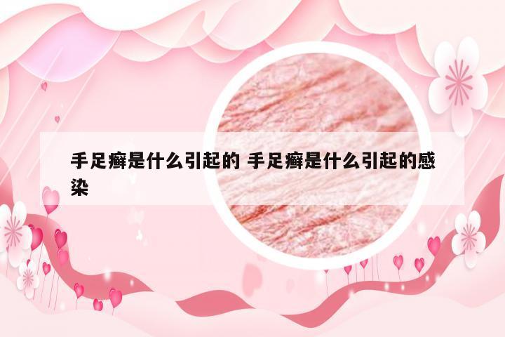 手足癣是什么引起的 手足癣是什么引起的感染