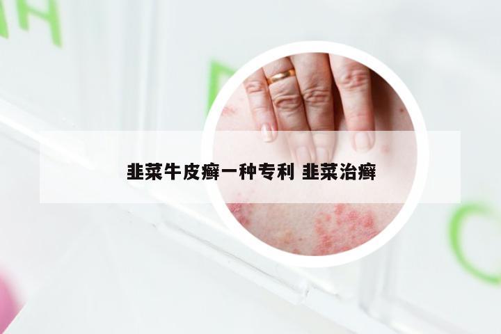 韭菜牛皮癣一种专利 韭菜治癣