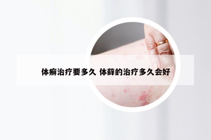 体癣治疗要多久 体藓的治疗多久会好