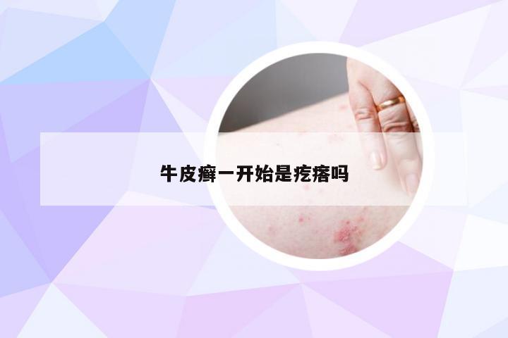 牛皮癣一开始是疙瘩吗