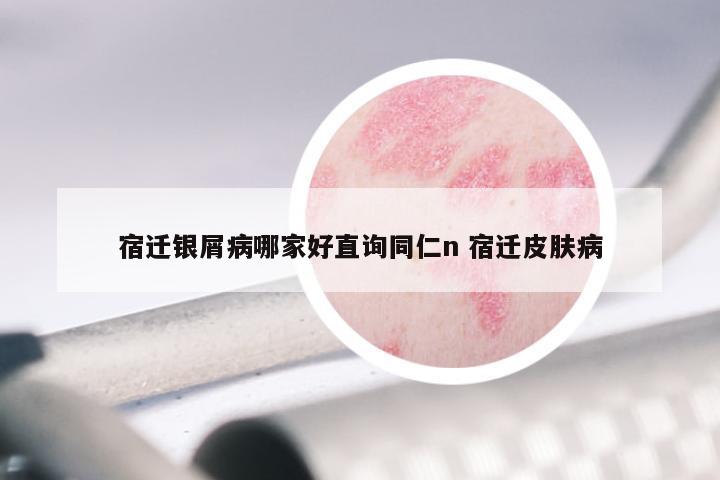 宿迁银屑病哪家好直询同仁n 宿迁皮肤病