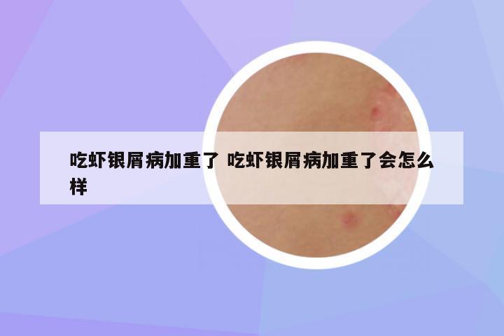 吃虾银屑病加重了 吃虾银屑病加重了会怎么样