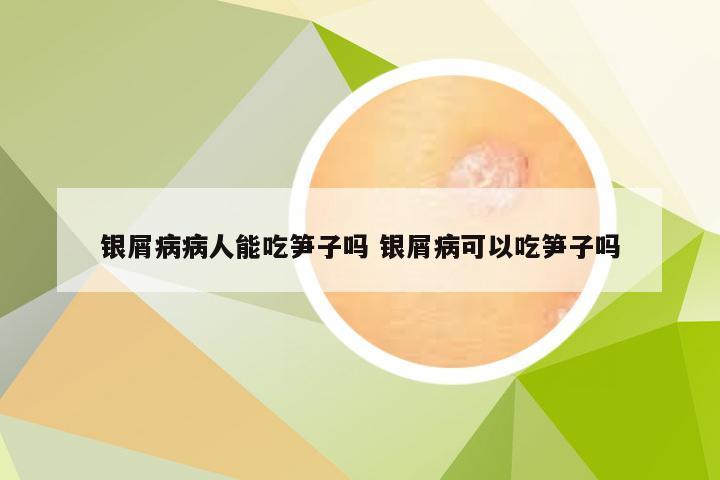 银屑病病人能吃笋子吗 银屑病可以吃笋子吗