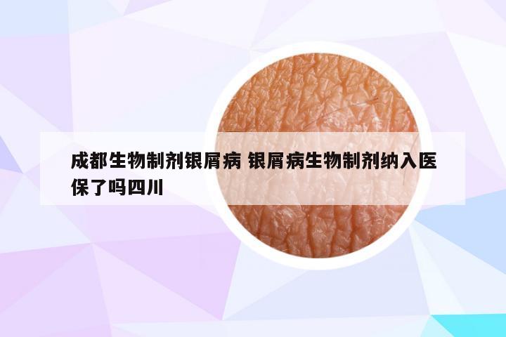 成都生物制剂银屑病 银屑病生物制剂纳入医保了吗四川