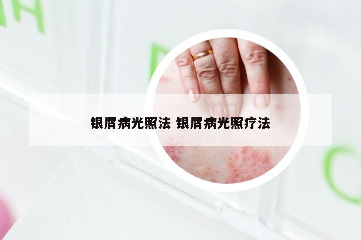 银屑病光照法 银屑病光照疗法