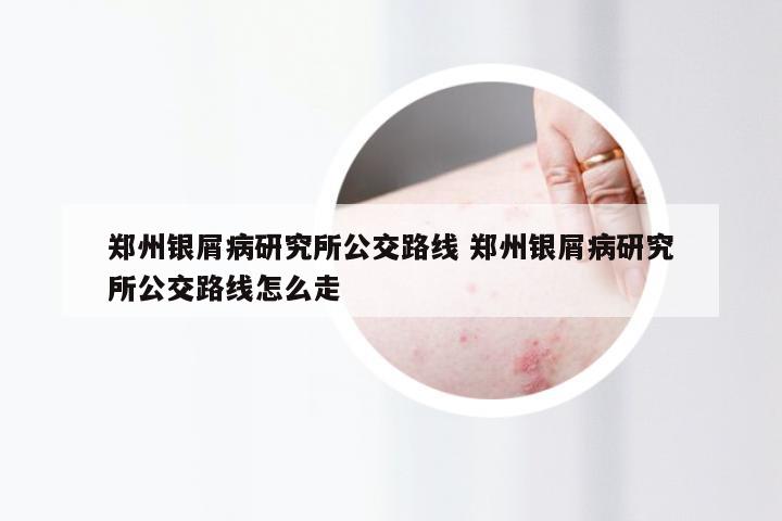郑州银屑病研究所公交路线 郑州银屑病研究所公交路线怎么走