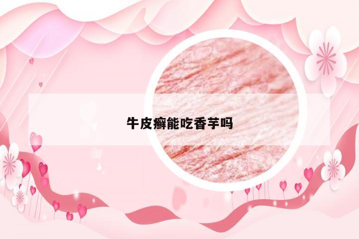 牛皮癣能吃香芋吗