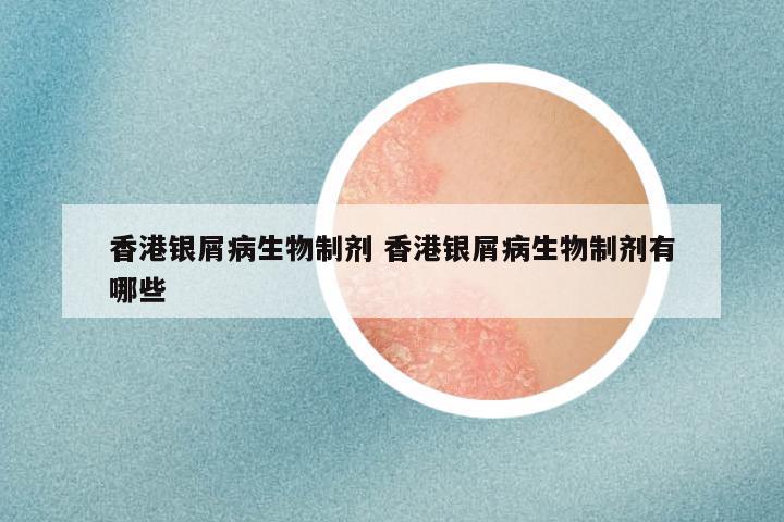 香港银屑病生物制剂 香港银屑病生物制剂有哪些