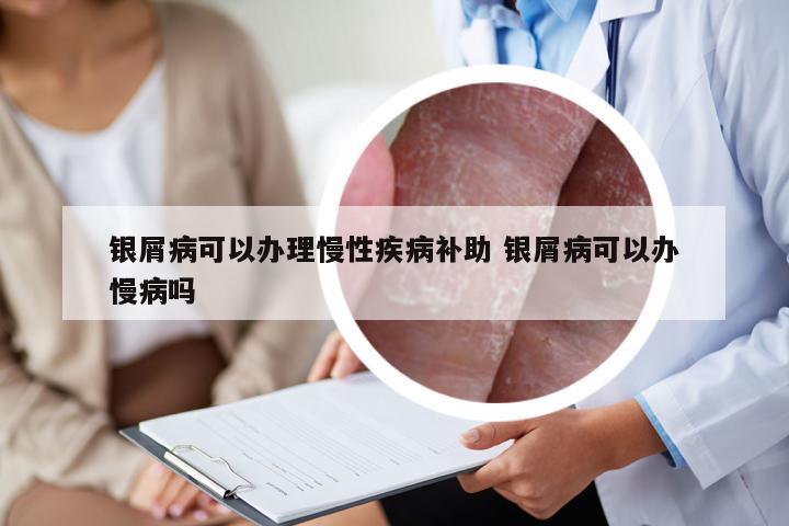 银屑病可以办理慢性疾病补助 银屑病可以办慢病吗