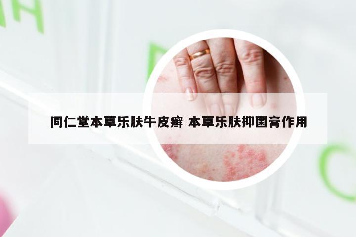 同仁堂本草乐肤牛皮癣 本草乐肤抑菌膏作用