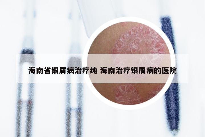 海南省银屑病治疗纯 海南治疗银屑病的医院