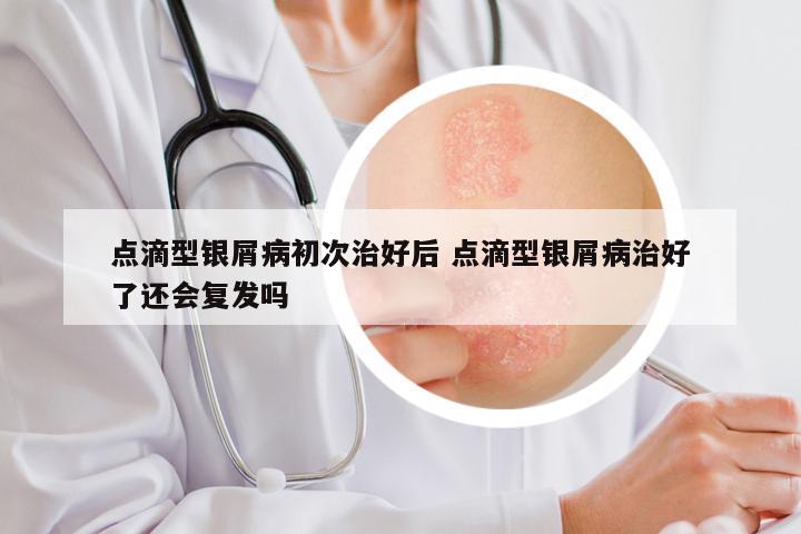 点滴型银屑病初次治好后 点滴型银屑病治好了还会复发吗