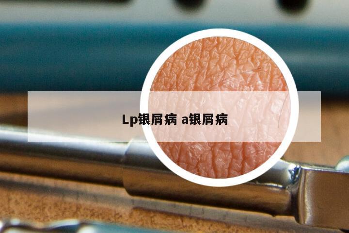 Lp银屑病 a银屑病