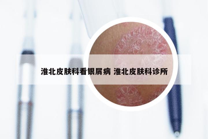 淮北皮肤科看银屑病 淮北皮肤科诊所