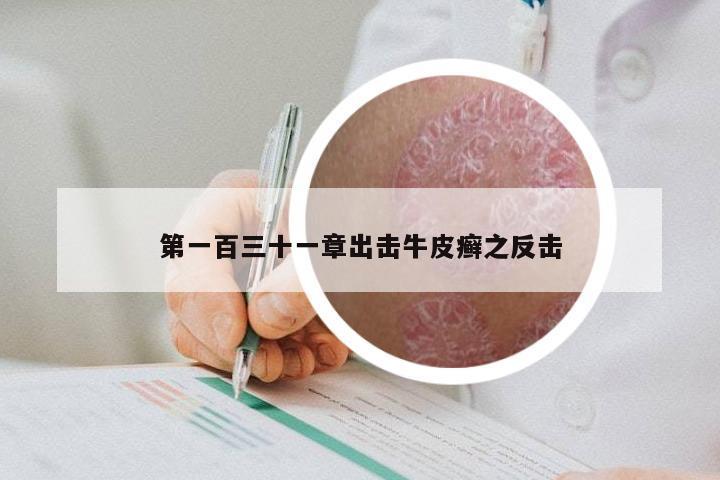 第一百三十一章出击牛皮癣之反击