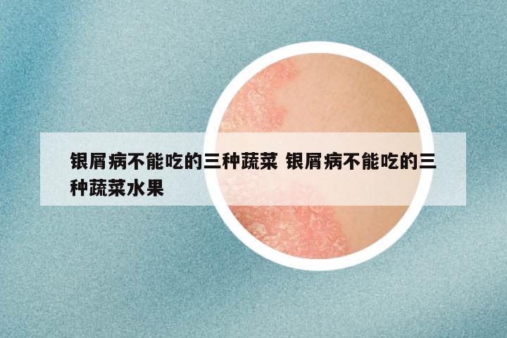 银屑病不能吃的三种蔬菜 银屑病不能吃的三种蔬菜水果