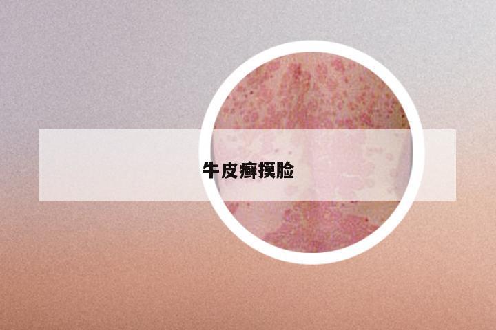 牛皮癣摸脸