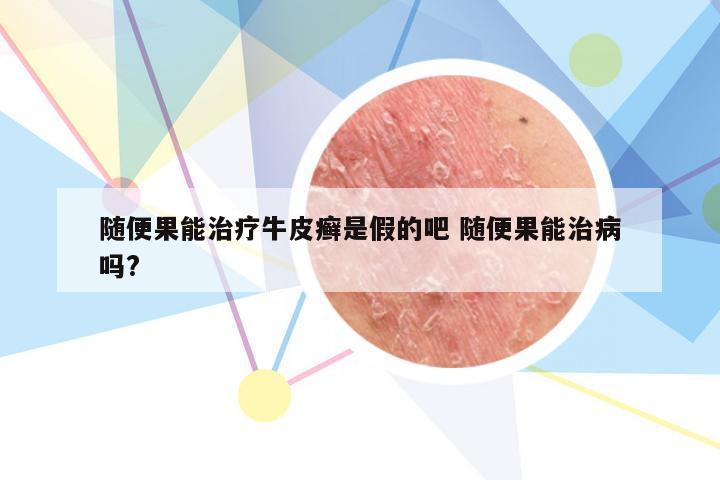 随便果能治疗牛皮癣是假的吧 随便果能治病吗?
