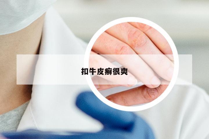 扣牛皮癣很爽