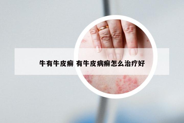 牛有牛皮癣 有牛皮病癣怎么治疗好