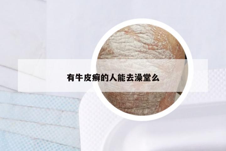 有牛皮癣的人能去澡堂么