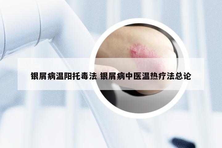 银屑病温阳托毒法 银屑病中医温热疗法总论
