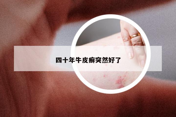 四十年牛皮癣突然好了