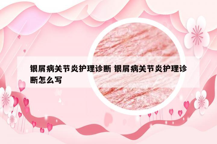 银屑病关节炎护理诊断 银屑病关节炎护理诊断怎么写