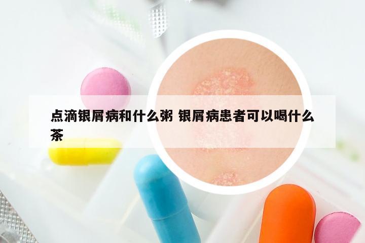 点滴银屑病和什么粥 银屑病患者可以喝什么茶