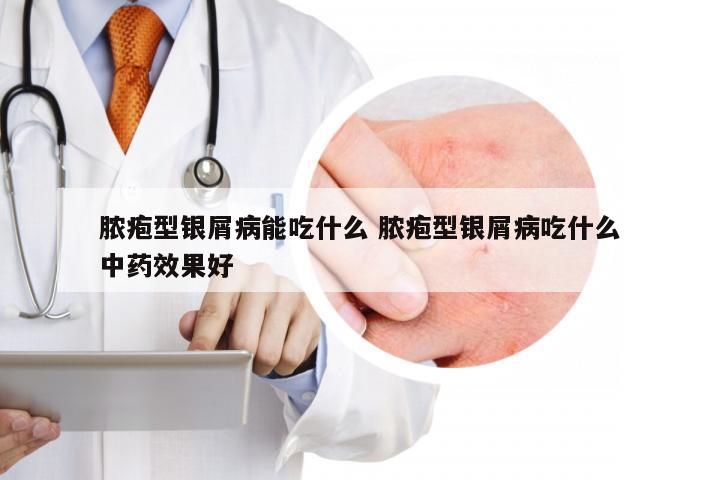 脓疱型银屑病能吃什么 脓疱型银屑病吃什么中药效果好