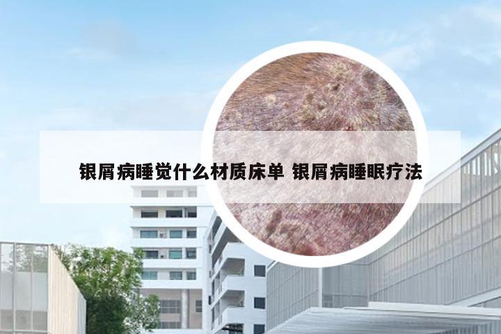 银屑病睡觉什么材质床单 银屑病睡眠疗法
