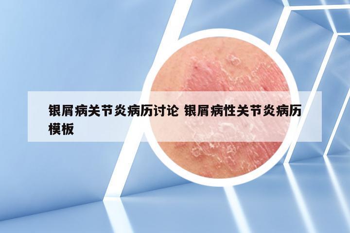 银屑病关节炎病历讨论 银屑病性关节炎病历模板