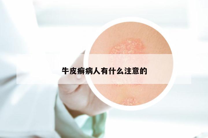 牛皮癣病人有什么注意的