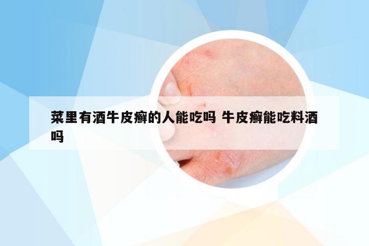 菜里有酒牛皮癣的人能吃吗 牛皮癣能吃料酒吗