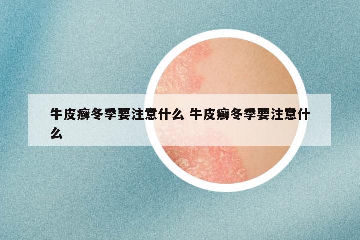 牛皮癣冬季要注意什么 牛皮癣冬季要注意什么