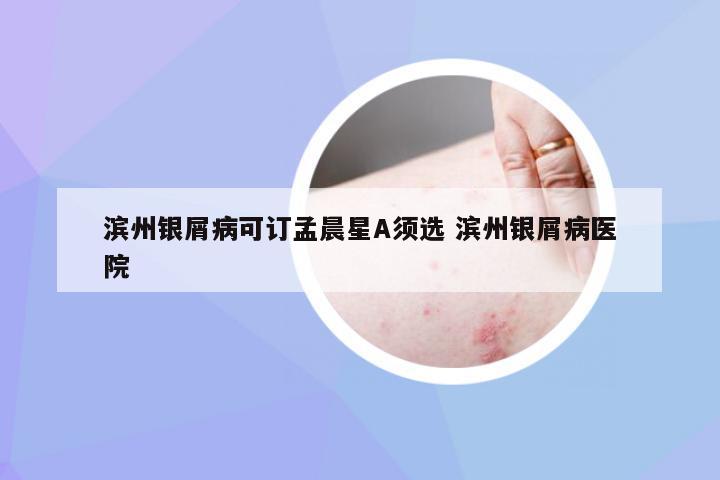 滨州银屑病可订孟晨星A须选 滨州银屑病医院