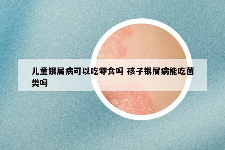 儿童银屑病可以吃零食吗 孩子银屑病能吃菌类吗