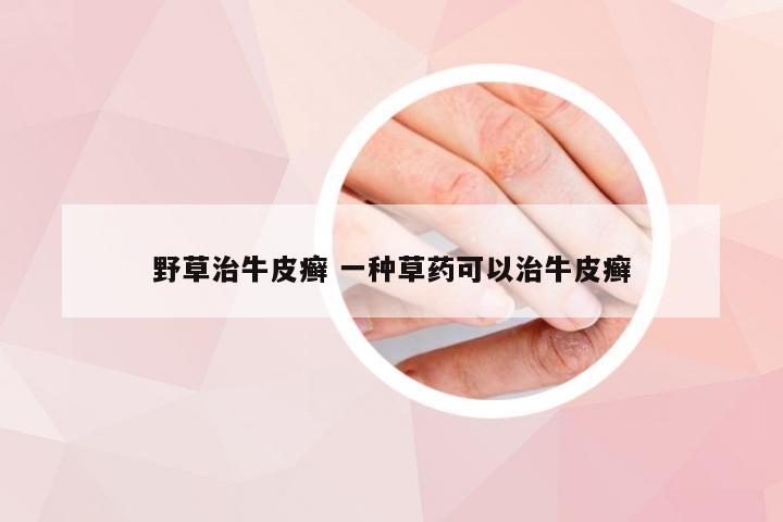 野草治牛皮癣 一种草药可以治牛皮癣