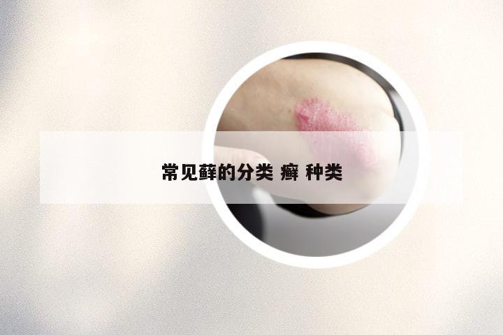 常见藓的分类 癣 种类