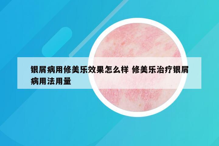 银屑病用修美乐效果怎么样 修美乐治疗银屑病用法用量
