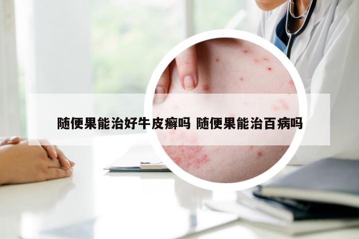 随便果能治好牛皮癣吗 随便果能治百病吗