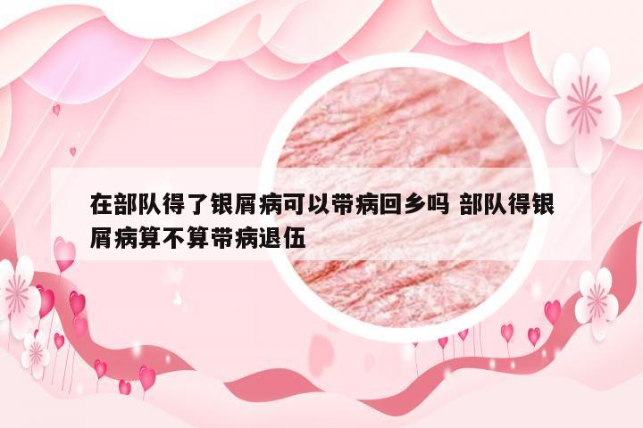 在部队得了银屑病可以带病回乡吗 部队得银屑病算不算带病退伍