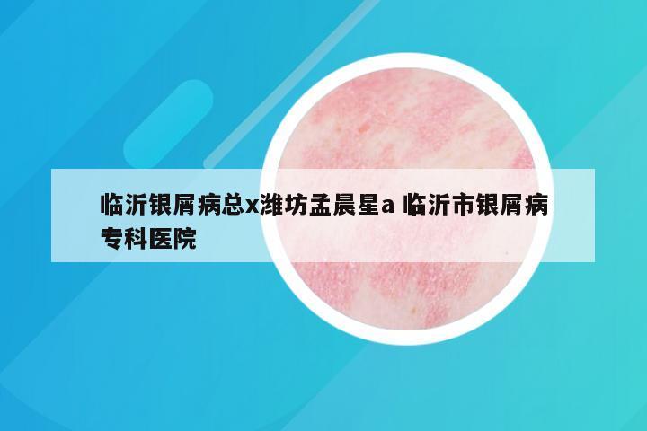 临沂银屑病总x潍坊孟晨星a 临沂市银屑病专科医院