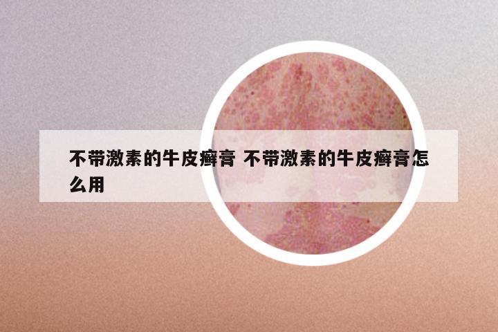 不带激素的牛皮癣膏 不带激素的牛皮癣膏怎么用