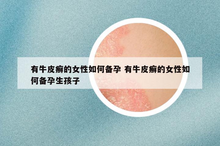 有牛皮癣的女性如何备孕 有牛皮癣的女性如何备孕生孩子