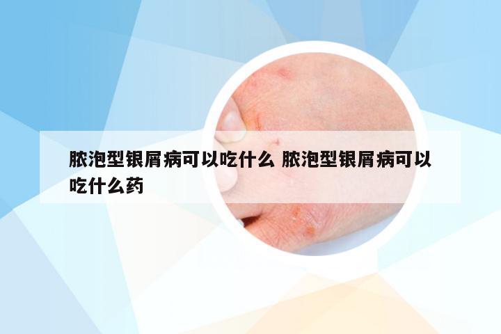 脓泡型银屑病可以吃什么 脓泡型银屑病可以吃什么药