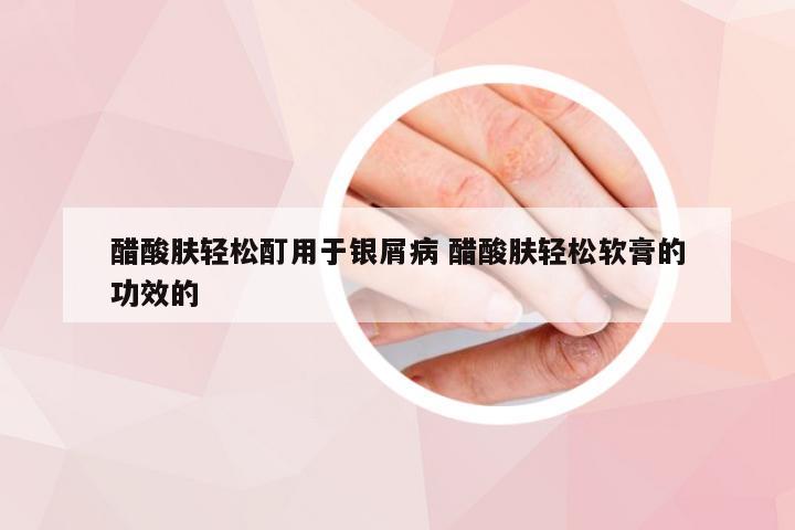醋酸肤轻松酊用于银屑病 醋酸肤轻松软膏的功效的