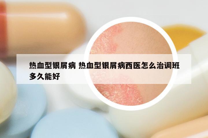 热血型银屑病 热血型银屑病西医怎么治调班多久能好