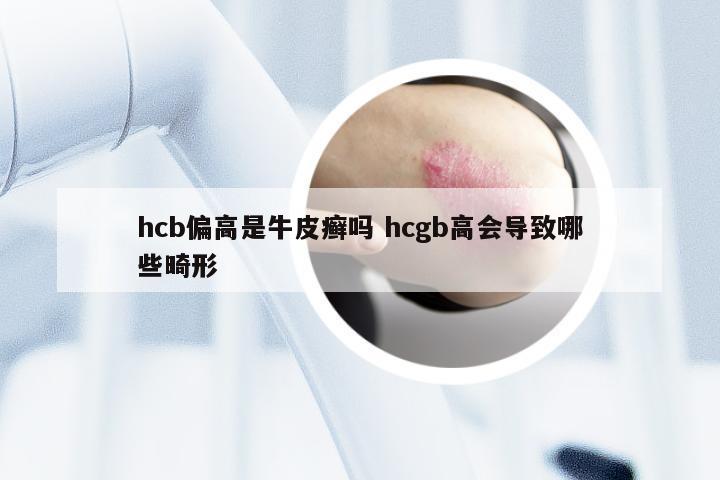 hcb偏高是牛皮癣吗 hcgb高会导致哪些畸形